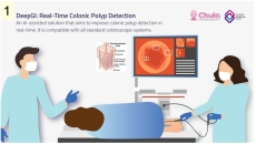 An animated visual of a gastrointestinal endoscopy procedure using DeepGI