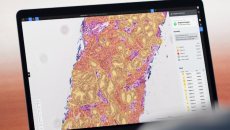 Deep Bio's prostate cancer analysis AI