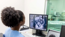 Radiologist looking at CAT scan monitor