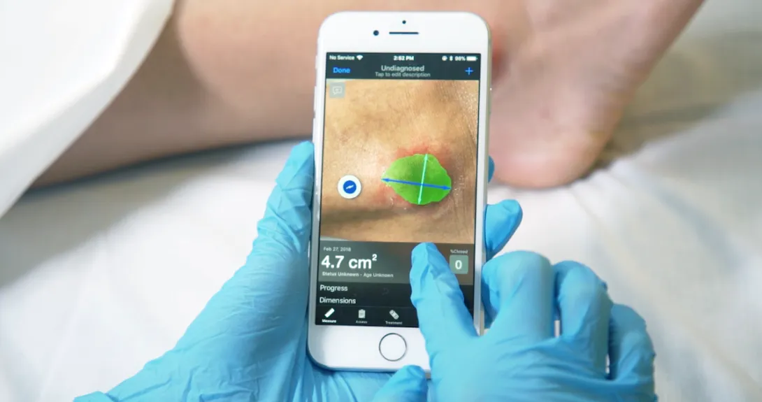 A smartphone analyzing a wound using Swift's app