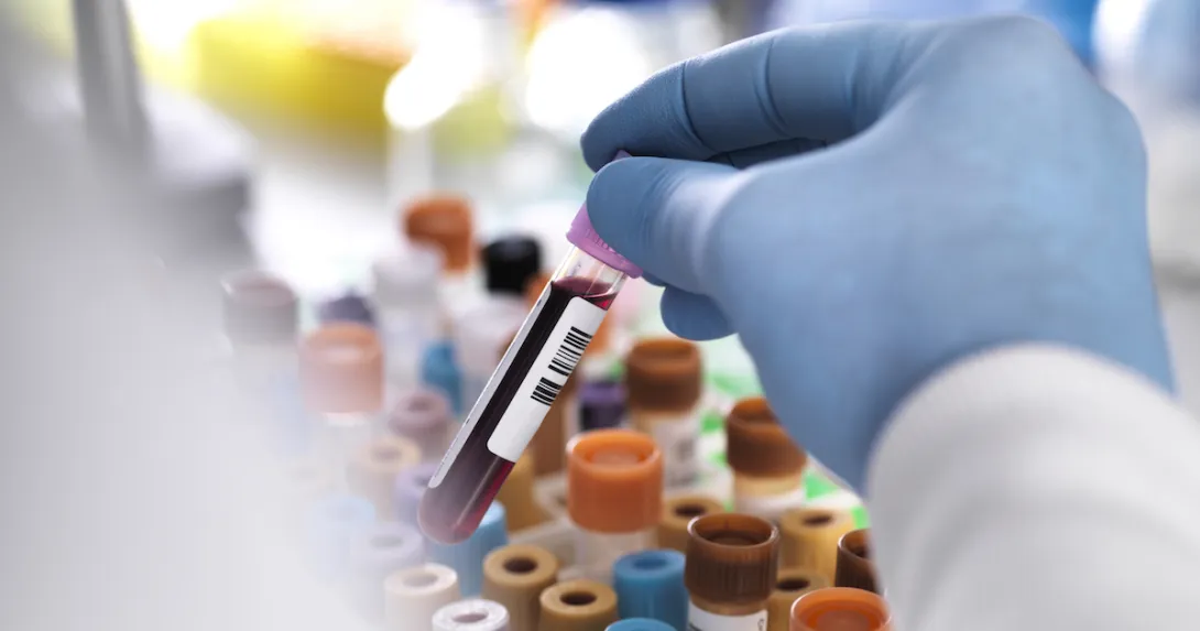A close up of a lab worker holding a tube of blood