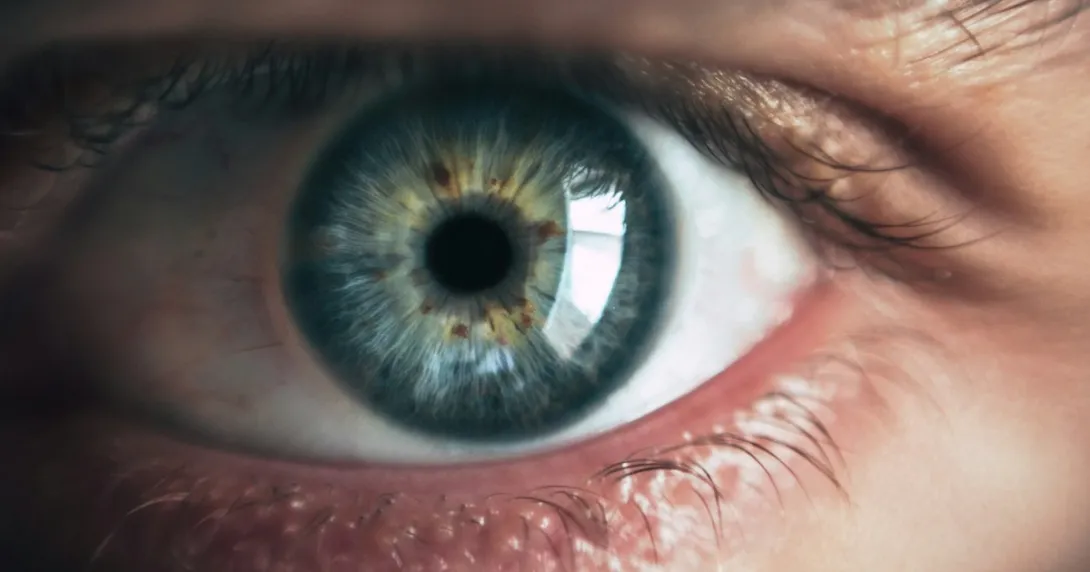 Alt text: A person's eye